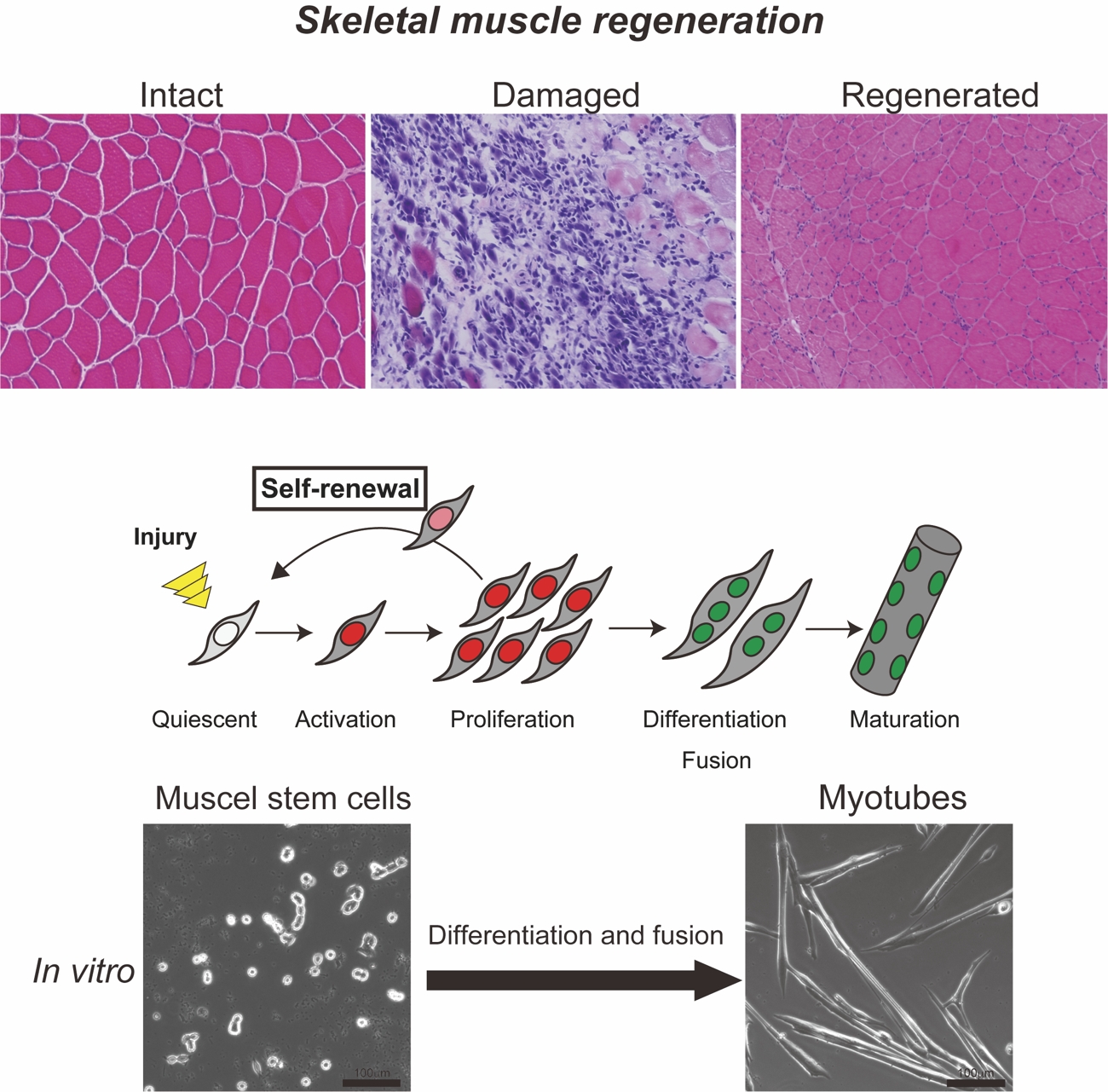 Regenerative Medicine